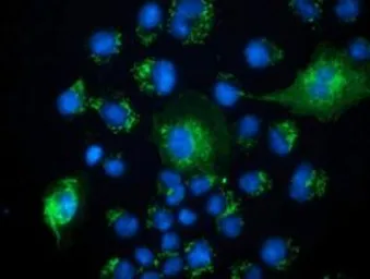 Anti-PECR antibody [1E4] used in Immunocytochemistry/ Immunofluorescence (ICC/IF). GTX83911