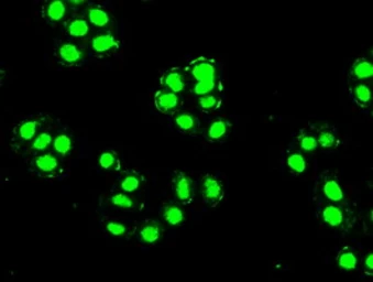 Anti-PDX1 antibody [2A12] used in Immunocytochemistry/ Immunofluorescence (ICC/IF). GTX83919