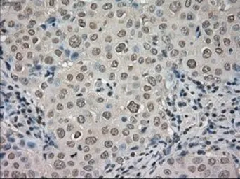 Anti-TrkC antibody [4E10] used in IHC (Paraffin sections) (IHC-P). GTX83977