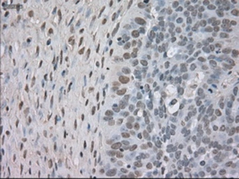 Anti-TrkC antibody [4E10] used in IHC (Paraffin sections) (IHC-P). GTX83977