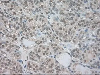 Anti-TrkC antibody [4E10] used in IHC (Paraffin sections) (IHC-P). GTX83977