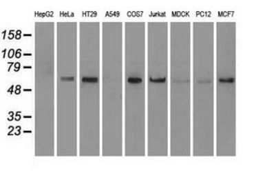 Anti-NRBP1 antibody [7E2] used in Western Blot (WB). GTX84000