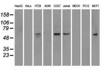 Anti-NRBP1 antibody [6C11] used in Western Blot (WB). GTX84003