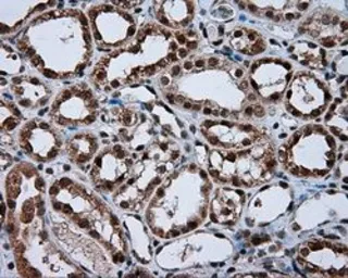 Anti-NPR-C antibody [4C3] used in IHC (Paraffin sections) (IHC-P). GTX84010