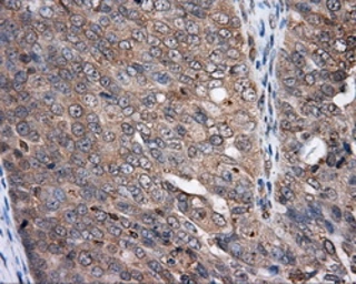 Anti-NPR-C antibody [11B5] used in IHC (Paraffin sections) (IHC-P). GTX84015