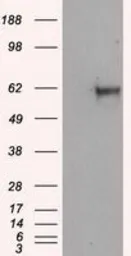 Anti-NPR-C antibody [11B5] used in Western Blot (WB). GTX84015