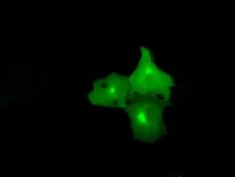Anti-NPR-C antibody [11B5] used in Immunocytochemistry/ Immunofluorescence (ICC/IF). GTX84015