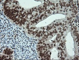 Anti-NOTCH1 antibody [4C9] used in IHC (Paraffin sections) (IHC-P). GTX84020