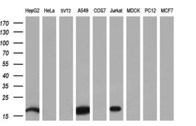 Anti-NME4 antibody [5E4] used in Western Blot (WB). GTX84028