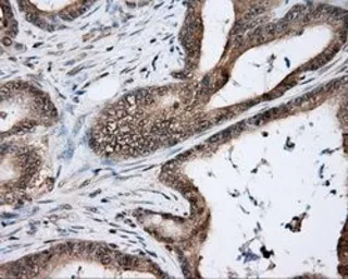 Anti-NIT2 antibody [6H7] used in IHC (Paraffin sections) (IHC-P). GTX84040