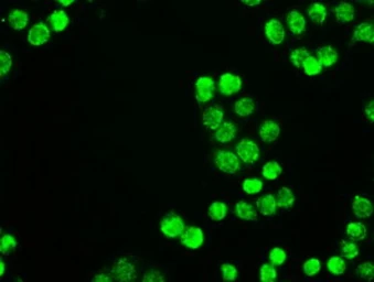 Anti-Neurogenin 1 antibody [8G8] used in Immunocytochemistry/ Immunofluorescence (ICC/IF). GTX84047