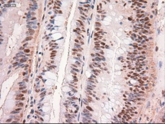 Anti-c-Myc antibody [3F2] used in IHC (Paraffin sections) (IHC-P). GTX84065