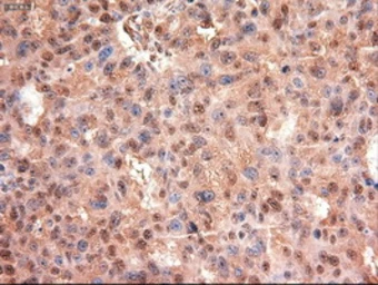 Anti-c-Myc antibody [3F2] used in IHC (Paraffin sections) (IHC-P). GTX84065