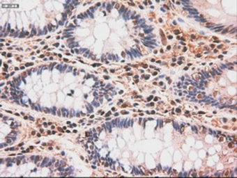 Anti-c-Myc antibody [3F2] used in IHC (Paraffin sections) (IHC-P). GTX84065