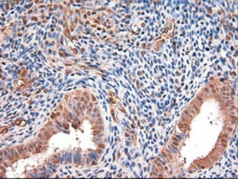 Anti-c-Myc antibody [3F2] used in IHC (Paraffin sections) (IHC-P). GTX84065
