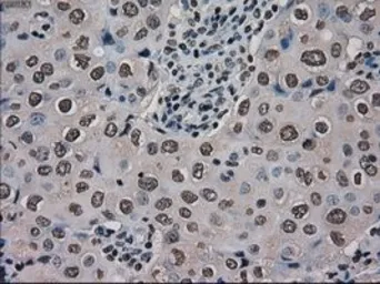 Anti-Ki67 antibody [3D11] used in IHC (Paraffin sections) (IHC-P). GTX84107