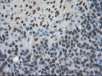 Anti-Ki67 antibody [3D11] used in IHC (Paraffin sections) (IHC-P). GTX84107