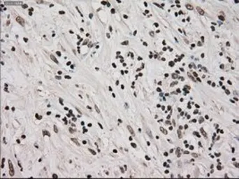 Anti-Ki67 antibody [3D11] used in IHC (Paraffin sections) (IHC-P). GTX84107