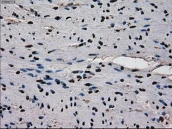 Anti-Ki67 antibody [3D11] used in IHC (Paraffin sections) (IHC-P). GTX84107
