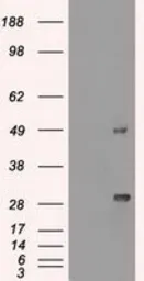 Anti-Ki67 antibody [3D11] used in Western Blot (WB). GTX84107