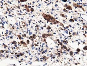 Anti-MICAL1 antibody [4B1] used in IHC (Paraffin sections) (IHC-P). GTX84121
