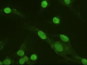 Anti-ERK3 antibody [5E1] used in Immunocytochemistry/ Immunofluorescence (ICC/IF). GTX84146