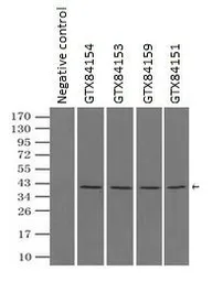 Anti-ERK2 antibody [4C2] used in Immunoprecipitation (IP). GTX84151