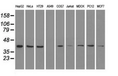 Anti-ERK2 antibody [6E5] used in Western Blot (WB). GTX84159