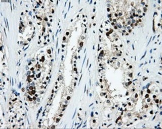 Anti-LOX antibody [6B11] used in IHC (Paraffin sections) (IHC-P). GTX84182