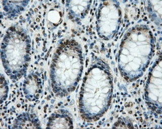 Anti-LOX antibody [6B11] used in IHC (Paraffin sections) (IHC-P). GTX84182