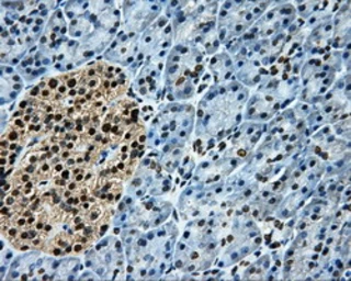 Anti-LOX antibody [6B11] used in IHC (Paraffin sections) (IHC-P). GTX84182