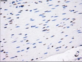 Anti-LOX antibody [5C4] used in IHC (Paraffin sections) (IHC-P). GTX84188