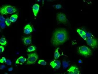 Anti-LOX antibody [5C4] used in Immunocytochemistry/ Immunofluorescence (ICC/IF). GTX84188