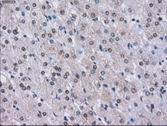 Anti-LOX antibody [9A11] used in IHC (Paraffin sections) (IHC-P). GTX84189