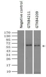 Anti-Endothelial Lipase / LIPG antibody [1B8] used in Immunoprecipitation (IP). GTX84209