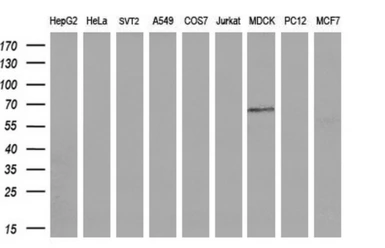 Anti-Endothelial Lipase / LIPG antibody [1B8] used in Western Blot (WB). GTX84209
