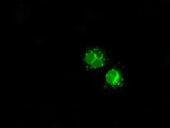 Anti-LEMD3 antibody [3H1] used in Immunocytochemistry/ Immunofluorescence (ICC/IF). GTX84221