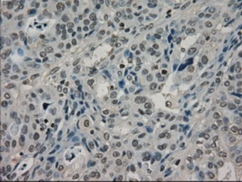 Anti-LDHA antibody [2D11] used in IHC (Paraffin sections) (IHC-P). GTX84227