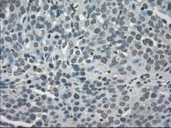Anti-LDHA antibody [2D11] used in IHC (Paraffin sections) (IHC-P). GTX84227