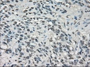 Anti-LDHA antibody [2D11] used in IHC (Paraffin sections) (IHC-P). GTX84227