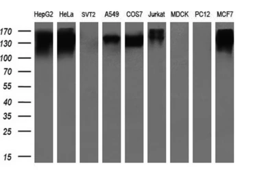 Anti-L1CAM antibody [1A8] used in Western Blot (WB). GTX84236
