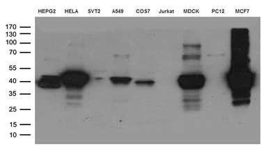 Anti-Cytokeratin 8 antibody [4D12] used in Western Blot (WB). GTX84248
