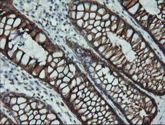 Anti-Cytokeratin 19 antibody [3F8] used in IHC (Paraffin sections) (IHC-P). GTX84251