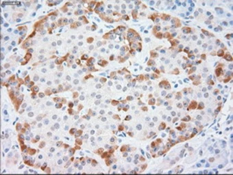 Anti-Cytokeratin 18 antibody [1H10] used in IHC (Paraffin sections) (IHC-P). GTX84254