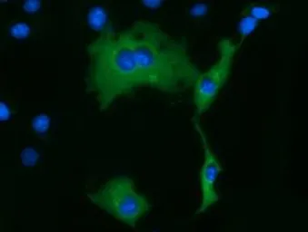 Anti-KLHL2 antibody [6D8] used in Immunocytochemistry/ Immunofluorescence (ICC/IF). GTX84261