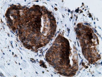 Anti-Ketohexokinase antibody [3D1] used in IHC (Paraffin sections) (IHC-P). GTX84277