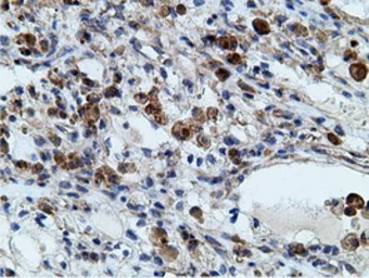Anti-Ketohexokinase antibody [3D1] used in IHC (Paraffin sections) (IHC-P). GTX84277