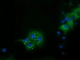 Anti-IVD antibody [1B10] used in Immunocytochemistry/ Immunofluorescence (ICC/IF). GTX84285
