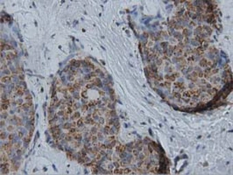 Anti-IVD antibody [1B10] used in IHC (Paraffin sections) (IHC-P). GTX84285