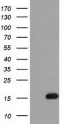 Anti-IL1F6 antibody [1A4] used in Western Blot (WB). GTX84298